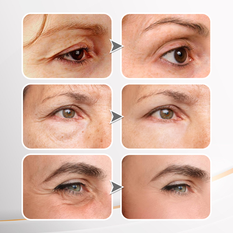 💐New packaging and fully upgraded formula✨Instant Wrinkle Eye Tightener cream