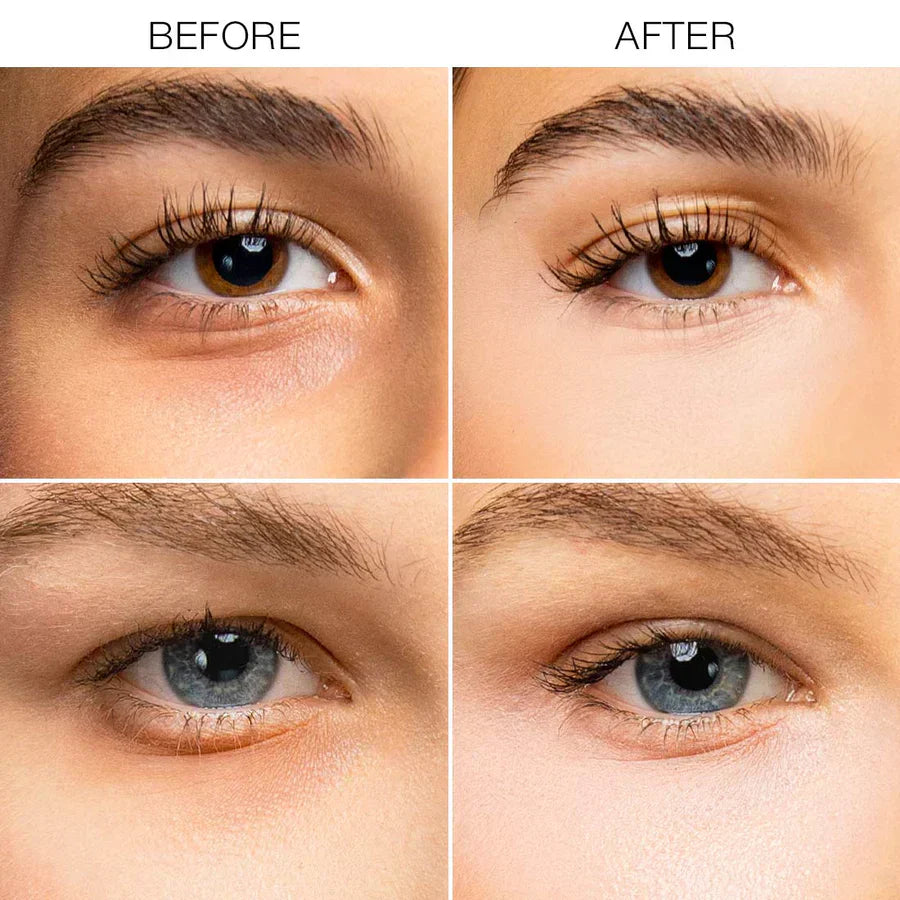 Insideefy™ Under Eye Brightener