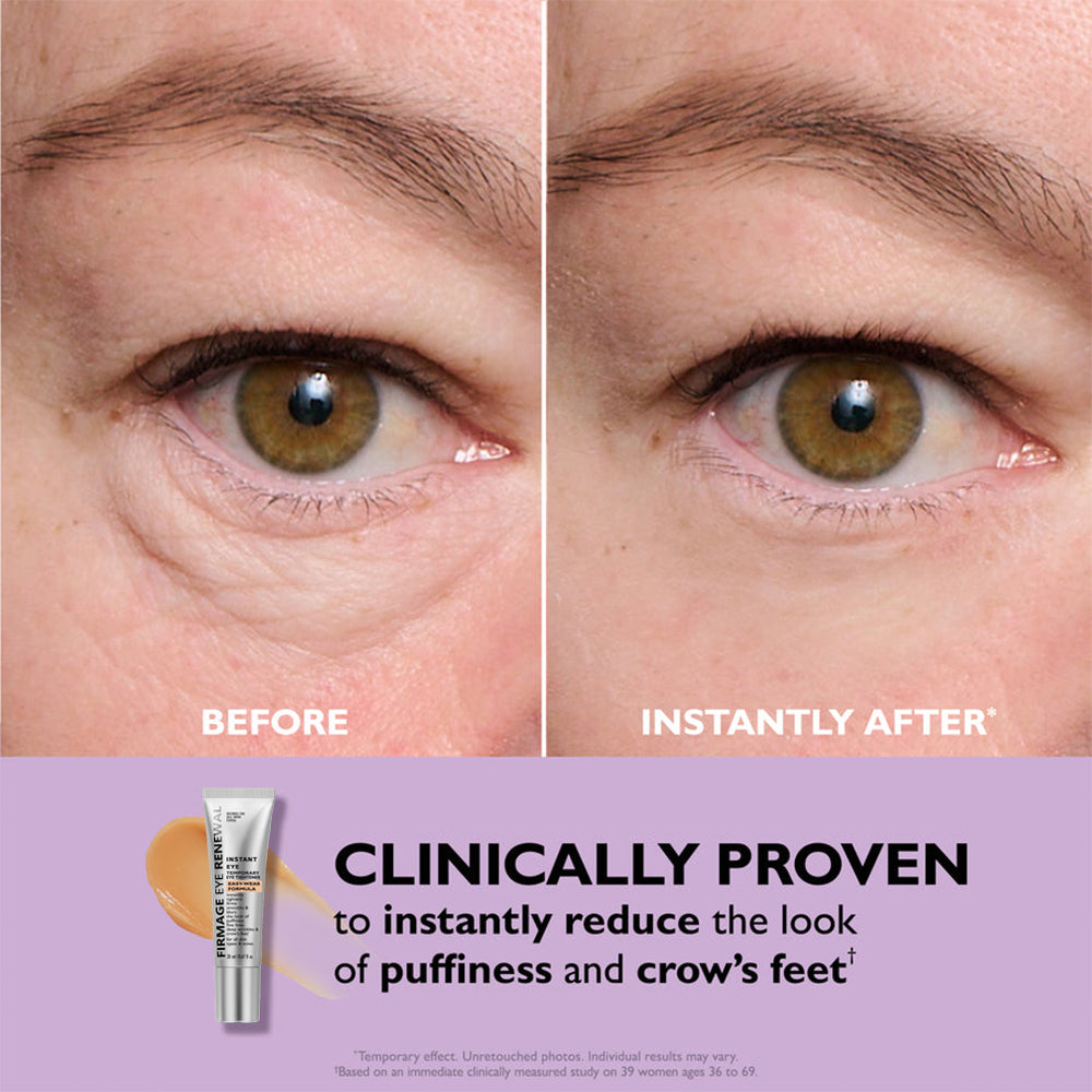 Say Goodbye to Tired Eyes – Instantly! ✨ New & Improved Formula – No White Residue, Just Instant Results! ✨