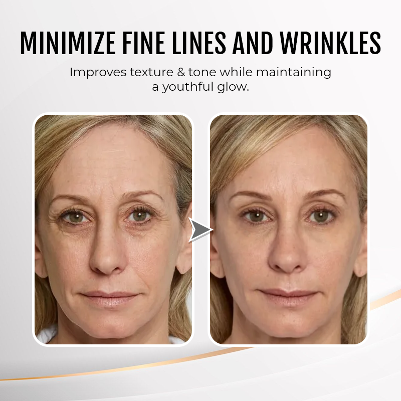 💐New packaging and fully upgraded formula✨Instant Wrinkle Eye Tightener cream