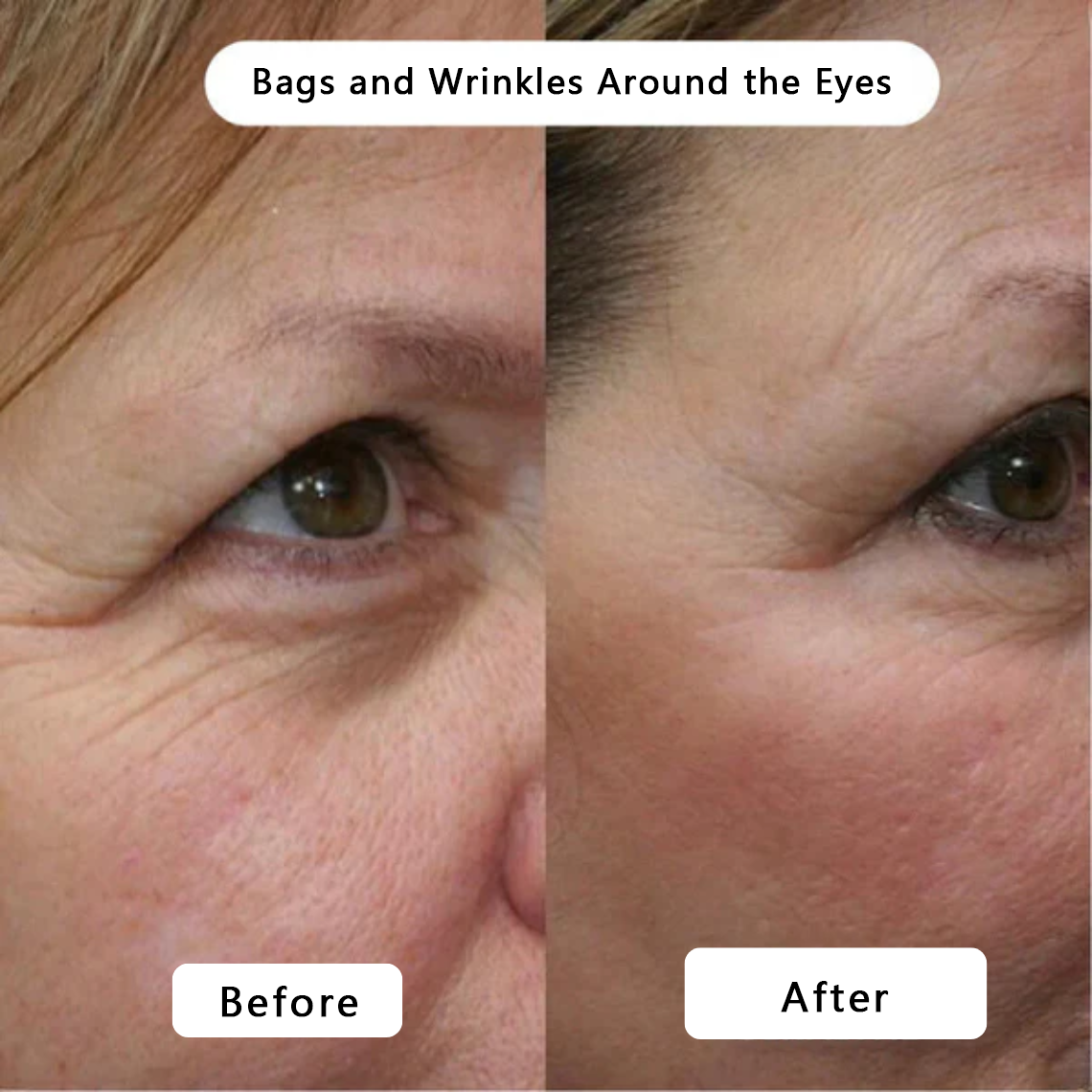 🍇Rejuvenate Your Skin with Micro Infusion Technology Tighter, Firmer & Younger-Looking Skin Starts Here