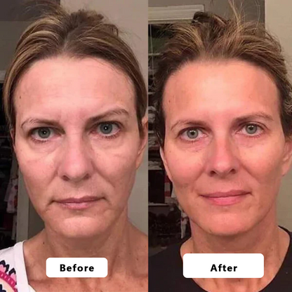 🍇Rejuvenate Your Skin with Micro Infusion Technology Tighter, Firmer & Younger-Looking Skin Starts Here