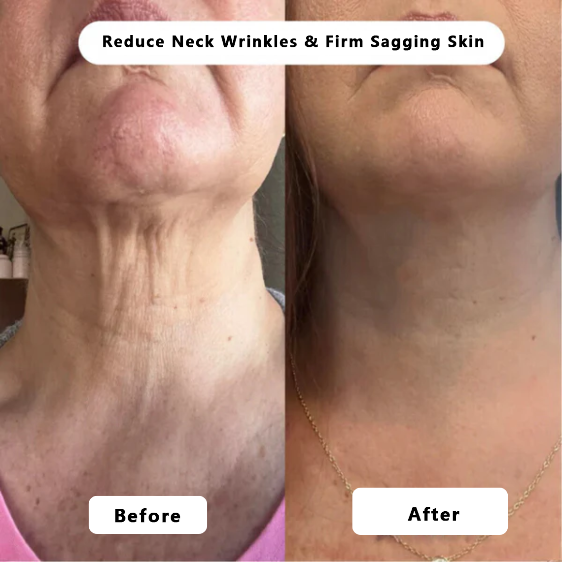 🍇Rejuvenate Your Skin with Micro Infusion Technology Tighter, Firmer & Younger-Looking Skin Starts Here