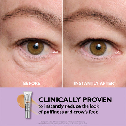 Say Goodbye to Tired Eyes – Instantly! ✨ New & Improved Formula – No White Residue, Just Instant Results! ✨