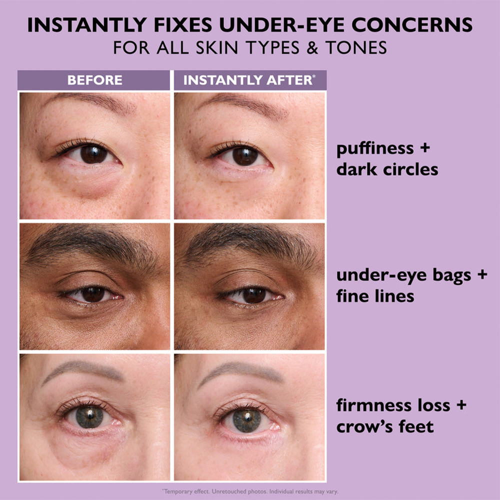 Say Goodbye to Tired Eyes – Instantly! ✨ New & Improved Formula – No White Residue, Just Instant Results! ✨